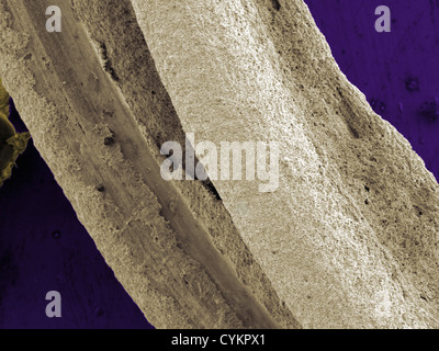 SEM di depositato chimicamente argento su substrati metallici Foto Stock