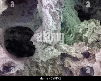 SEM di depositato chimicamente argento su substrati metallici Foto Stock