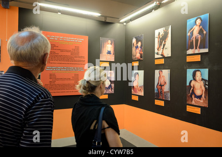 CITTÀ DI HO CHI MINH, Vietnam: I visitatori del museo esaminano le fotografie che documentano gli effetti intergenerazionali dell'esposizione dell'Agente Orange al Museo dei resti della guerra. La mostra mostra mostra mostra le prove dell'impatto a lungo termine sulla salute dei bambini nati dopo la guerra del Vietnam. Il museo conserva questa documentazione come parte della sua collezione permanente sugli effetti chimici defoglianti. Foto Stock