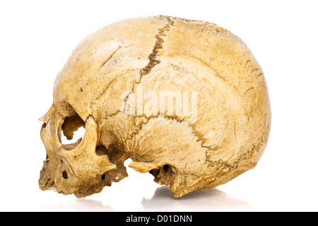 Un vecchio jawless Scull umano isolato su bianco Foto Stock