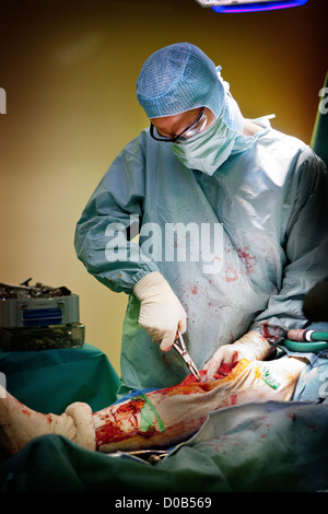 Protesi del ginocchio, chirurgia Foto Stock