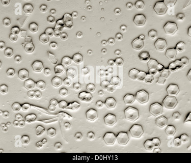 Cristalli di oligomero di tintura di fibre di poliestere, oblique  illuminazione trasmessa, x320 Foto stock - Alamy