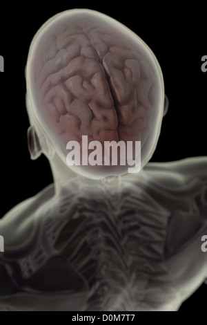 Parte posteriore vista di tre quarti di testa e lo scheletro con il cervello presente all'interno del cranio. Foto Stock