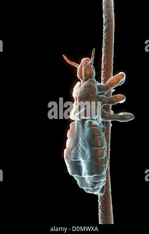 Testa di parassiti pidocchio aggrappato a un follicolo pilifero. Foto Stock