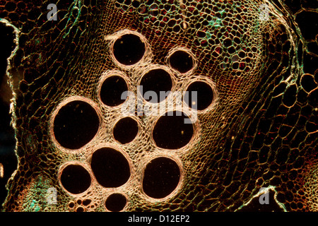 Micrografia tessuto vegetale, il gambo della zucca Foto Stock