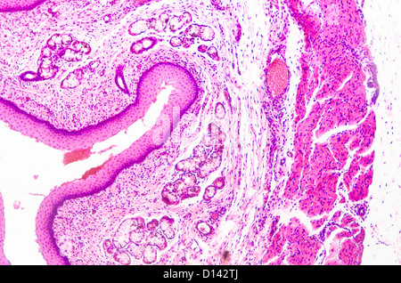 Micrografia di scienza medica epitelio squamoso stratificato della cellula di tessuto Foto Stock