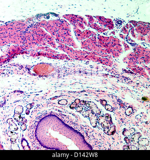 Micrografia di scienza medica epitelio squamoso stratificato della cellula di tessuto Foto Stock