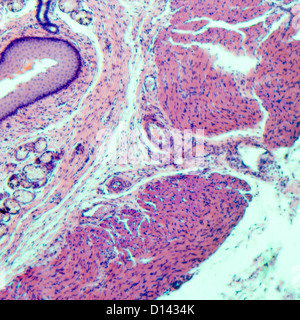 Micrografia di scienza medica epitelio squamoso stratificato della cellula di tessuto Foto Stock