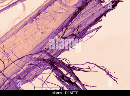 Micrografia elettronica a scansione di amianto Foto Stock