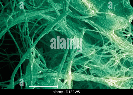 Micrografia elettronica a scansione di amianto, 5000x Foto Stock