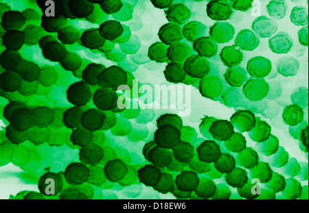 Micrografia elettronica, Aspergillus conidiospores Foto Stock