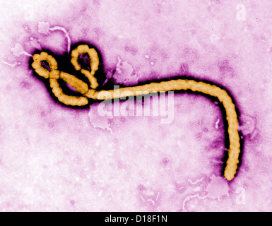 Microscopio elettronico a trasmissione del virus Ebola Foto Stock