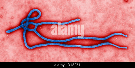 Microscopio elettronico a trasmissione del virus Ebola Foto Stock