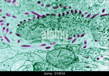 Microscopio elettronico a trasmissione del virus Ebola Foto Stock