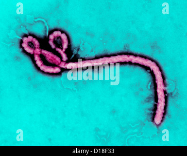 Microscopio elettronico a trasmissione del virus Ebola Foto Stock