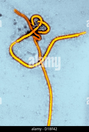 Microscopio elettronico a trasmissione del virus Ebola Foto Stock