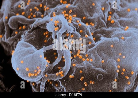 Micrografia elettronica a scansione di erba del virus HIV Foto Stock