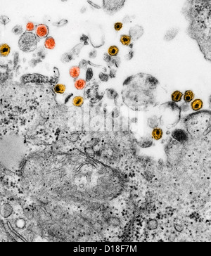 Microscopio elettronico a trasmissione di HTLV e HIV Foto Stock