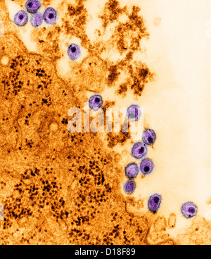 Micrografia elettronica di virus HIV Foto Stock