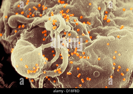 Micrografia elettronica a scansione di erba del virus HIV Foto Stock