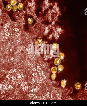 Micrografia elettronica di virus HIV Foto Stock