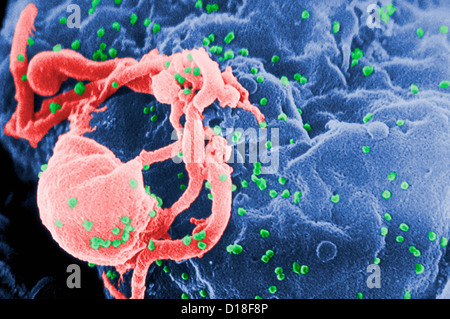 HIV-1 e linfociti umani Foto Stock