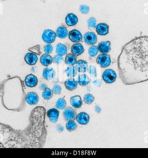 Micrografia elettronica di virus HIV Foto Stock