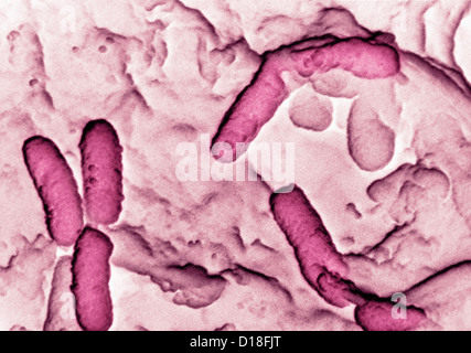 Micrografia elettronica di Pseudomonas aeruginosa Foto Stock