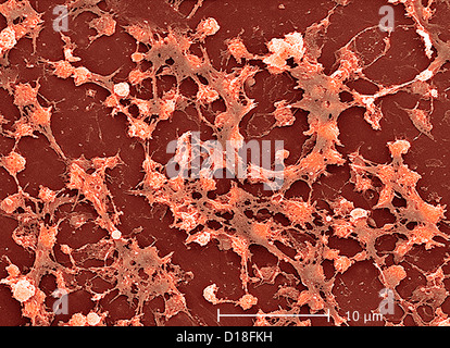 Micrografia elettronica di Staphylococcus aureus Foto Stock