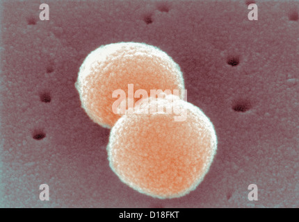 Micrografia elettronica di Streptococcus pneumoniae Foto Stock