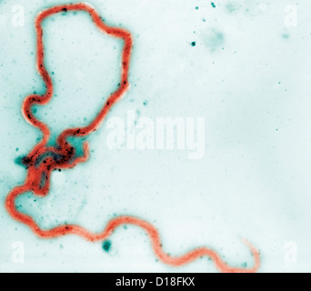 La fotomicrografia del Treponema pallidum batteri Foto Stock