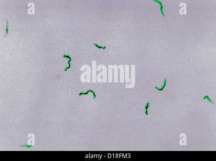 La fotomicrografia del Treponema pallidum batteri Foto Stock