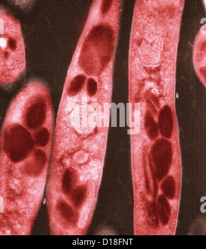 Micrografia elettronica di Bacillus anthracis batteri Foto Stock