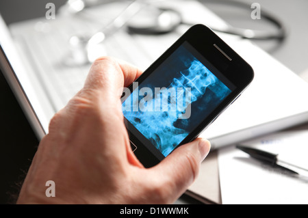 Medico maschio guardando x-ray sullo smartphone Foto Stock