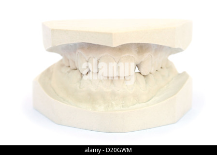 Denti modello in gesso isolati su sfondo bianco. Foto Stock