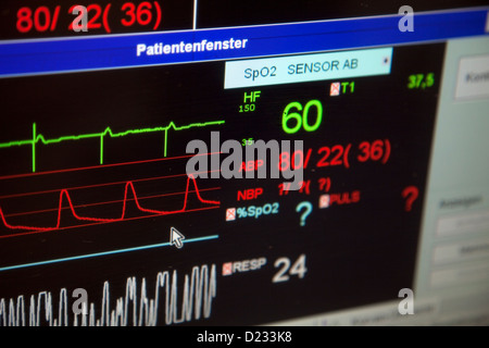Essen, Germania, un monitor per i segni vitali nelle unità di terapia intensiva di un ospedale Foto Stock
