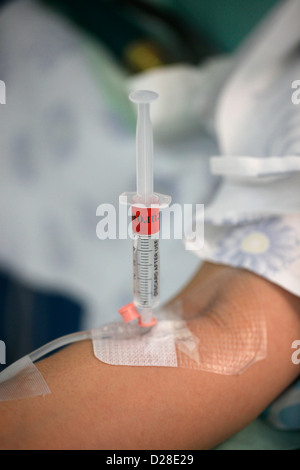 Un paziente che riceve farmaco tramite terapia intravenosa Foto Stock