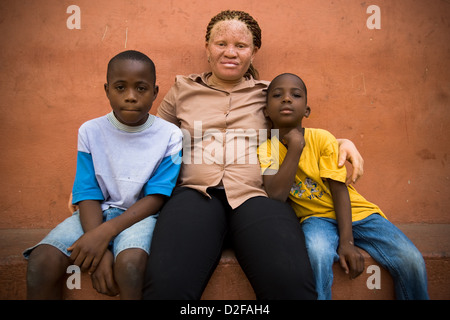 Albini africani la donna e i suoi due figli. Foto Stock