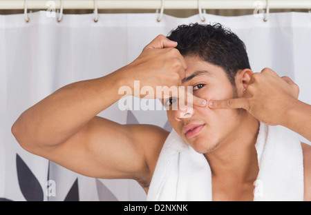 L'uomo schiacciando un brufolo sul suo volto Foto Stock