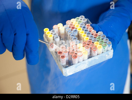 Essen, Germania, lo stelo di elaborazione della cella in ospedale Foto Stock