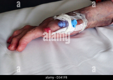 Cannula nella donna anziana il pollice della mano con molto schiacciato e Knuckles mostra Ostioartheritis in ospedale in Inghilterra Foto Stock