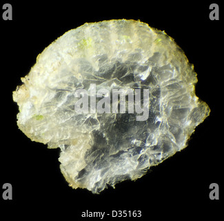 Ago riccio sotto il microscopio (Erinaceus europaeus) Foto Stock