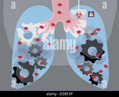 Immagine illustrativa dei polmoni umani infettati dal virus Foto Stock