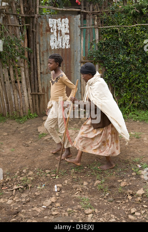 SORO città, zona WOLAYITA, sud Etiopia, 19AGOSTO 2008: Bushito Artori, 50 anni, è ora cieco dai fumi di woodsmoke Foto Stock