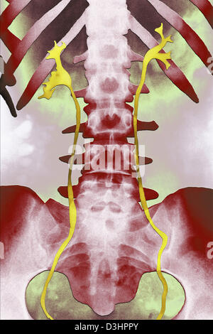 Il sistema urinario, X-RAY RICERCA Foto Stock