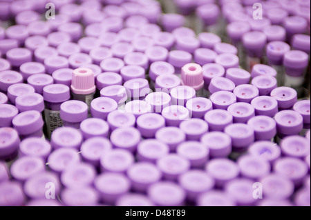 Le cime dei campioni di sangue testati e di analisi Foto Stock