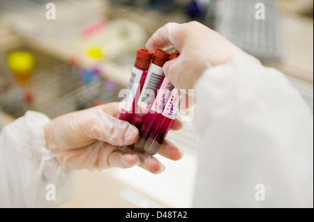 Close-up di campioni di sangue Foto Stock