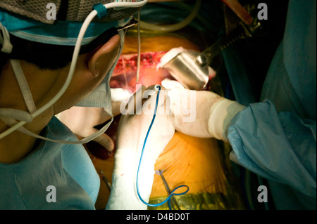 I chirurghi di eseguire un trapianto di fegato a Samsung Medical Center. Foto Stock