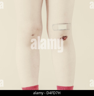 Primo piano delle gambe di un giovane bambino con ammaccature e bandaid Foto Stock