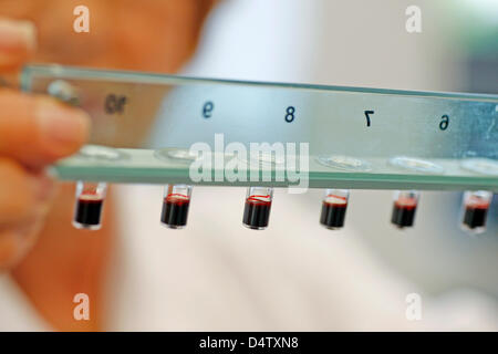 Questa dispensa non datata immagine mostra Elisabeth Perzborn chi è il responsabile per la pianificazione, l'esecuzione e il coordinamento delle attività di esplorazione di Rivaroxaban tenendo diversi campioni di sangue a Wuppertal, Germania. Il team intorno Perborn sviluppato una compressa contenente l'agente Rivaroxaban che può prevenire trombosi. In tal modo, è entrato nella finale del tedesco Premio future che saranno un Foto Stock